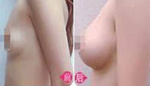 VISIA皮肤检测仪