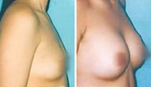 C6激光-终结各种斑点的祛斑神话