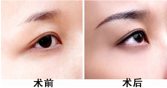 切眉的方法都有几种